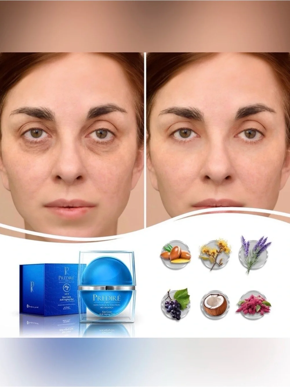 PREDIRE PARIS Intensive Rapid Renewal Rescue Eye Anti-Aging Gel ~ Retail $1250